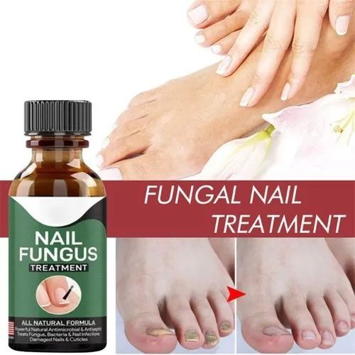 Fast Nail Fungus Treatment Serum (15ml)